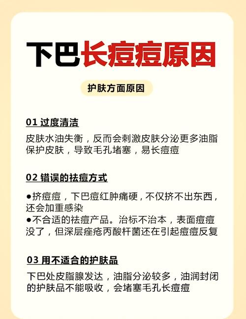 下颌长痘痘是什么原因