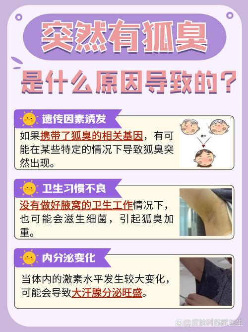突然有狐臭什么原因