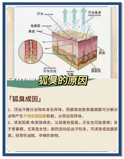突然有狐臭什么原因