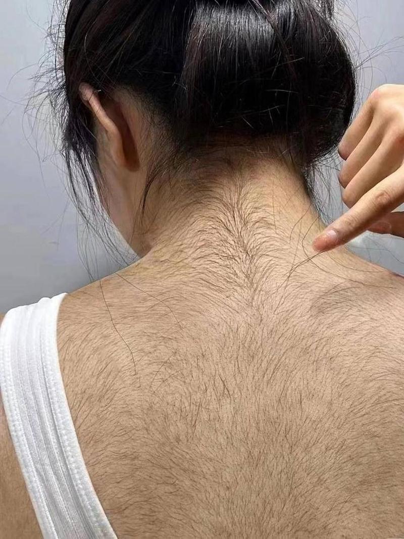 女生为什么有腿毛