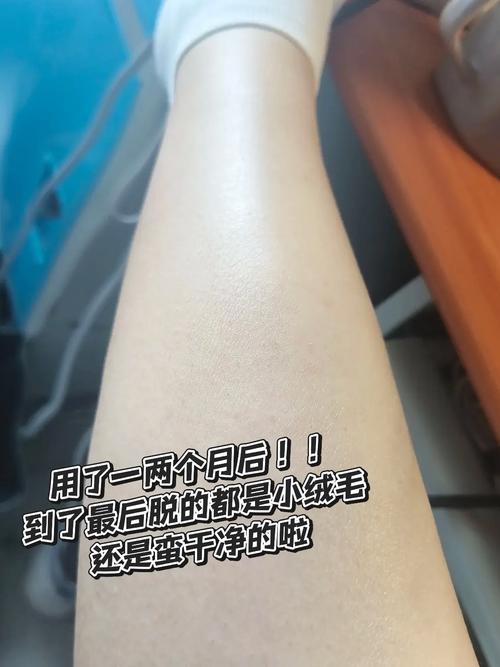 女生为什么有腿毛
