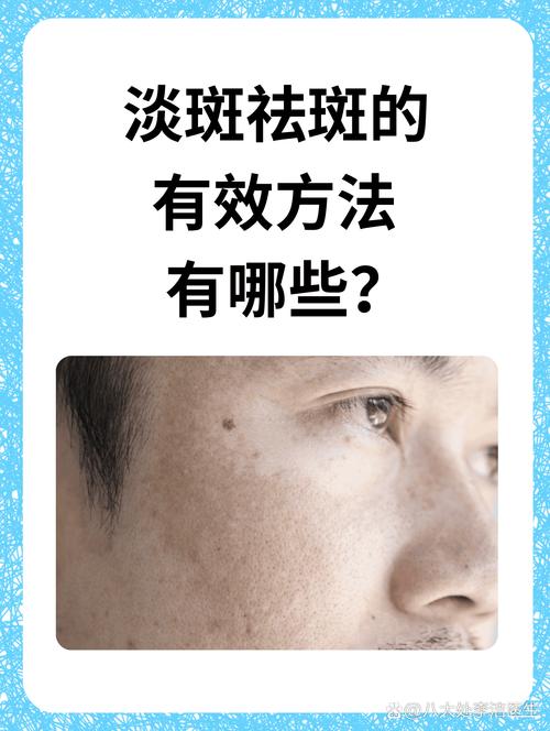 为什么男人不长斑