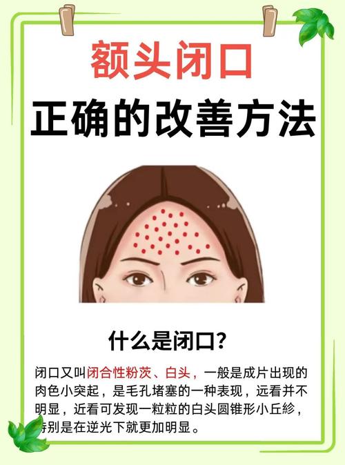 脸上闭口什么意思