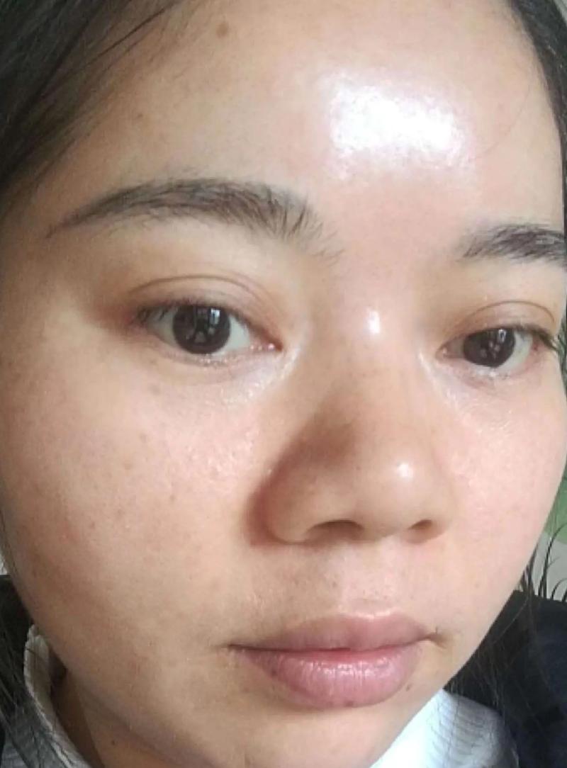 什么样的皮肤算好皮肤