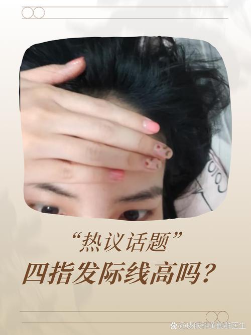 发际线为什么会变高