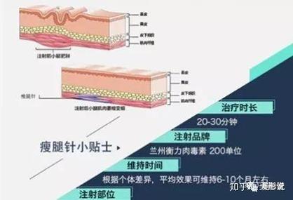 瘦腿针是什么原理