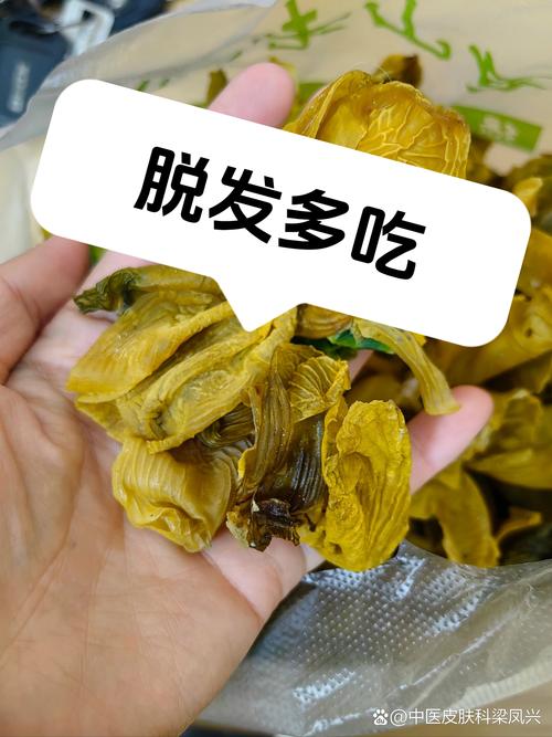 头发掉厉害吃什么好