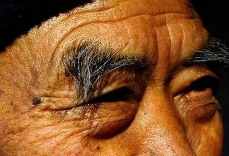 眉毛变长是什么原因