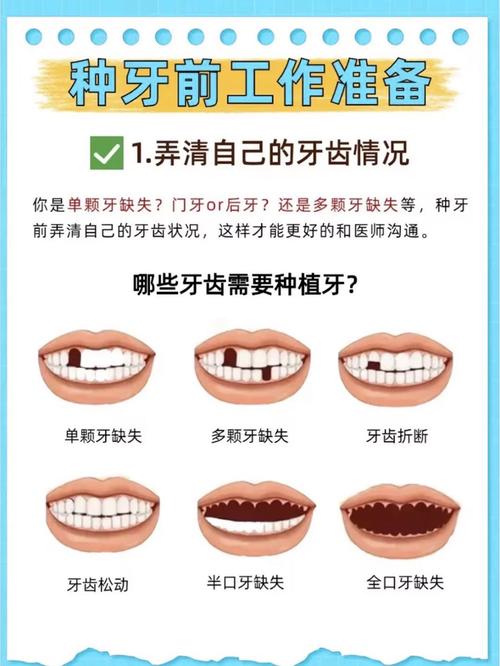 种植牙需要什么条件