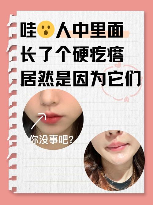 人中长痘痘为什么