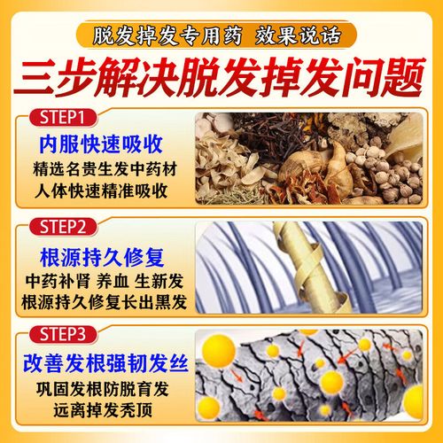 脂溢性脱发吃什么好