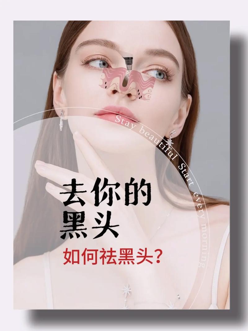 有什么去黑头
