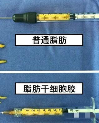 什么是脂肪胶