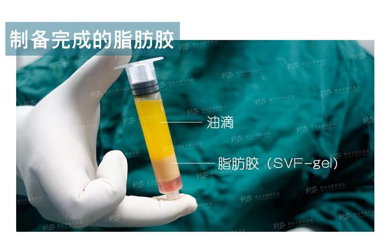什么是脂肪胶