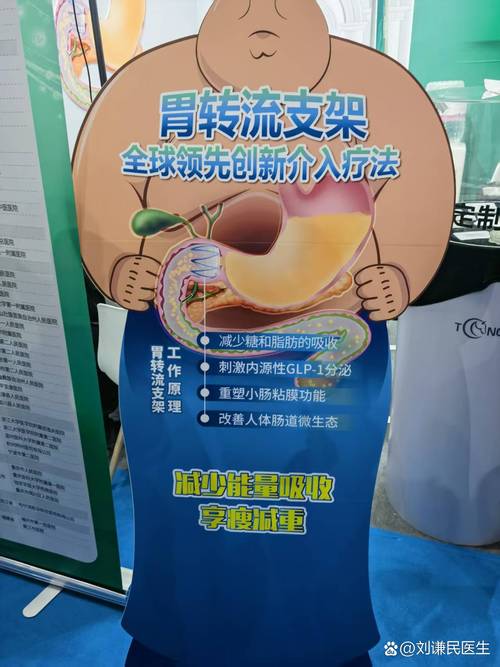 最好手术减肥方法是什么