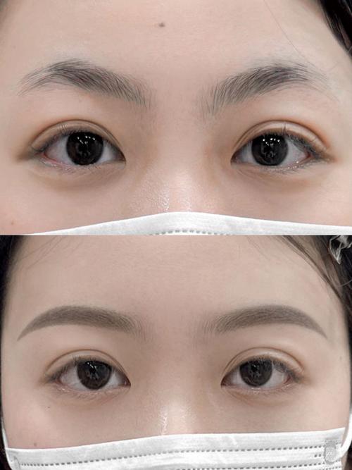 纹眉有什么害处