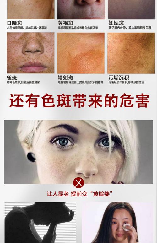 什么淡化色斑