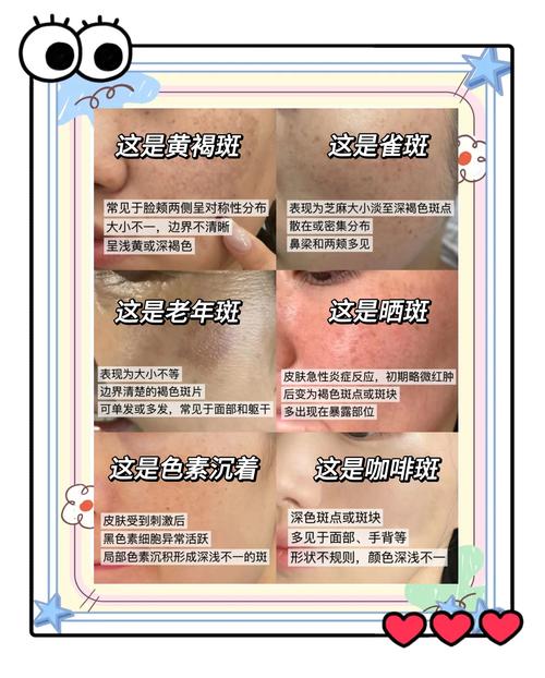 什么淡化色斑