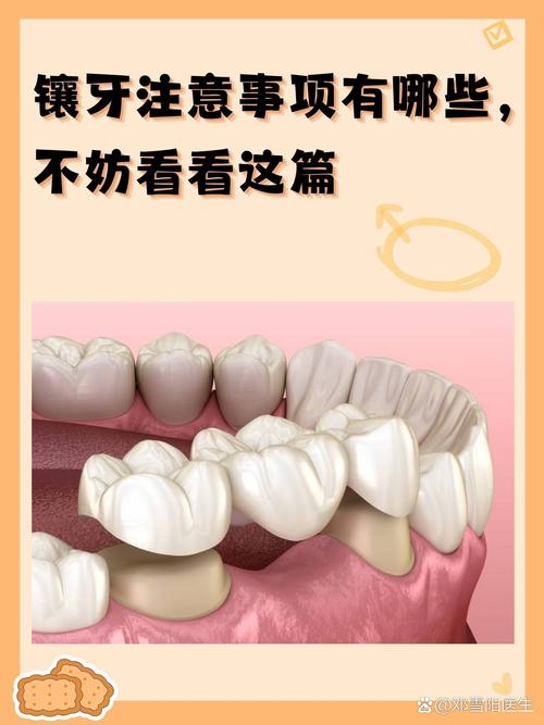 为什么镶牙