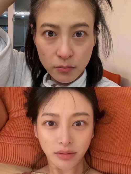 眼袋为什么越来越大