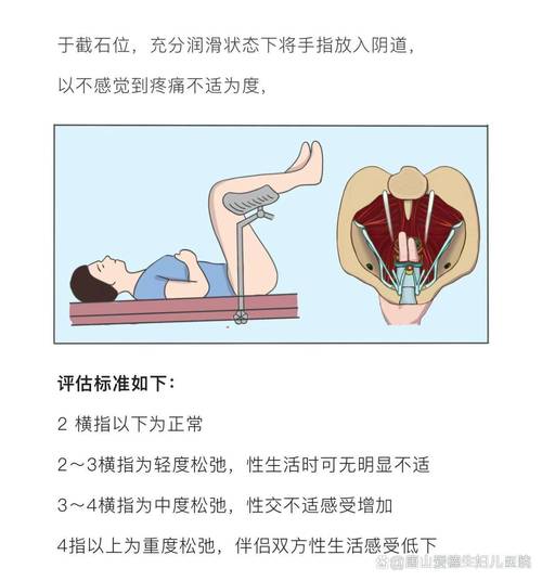阴道松弛是什么原因