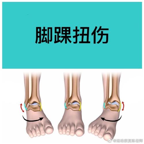 什么运动减肥不伤脚踝