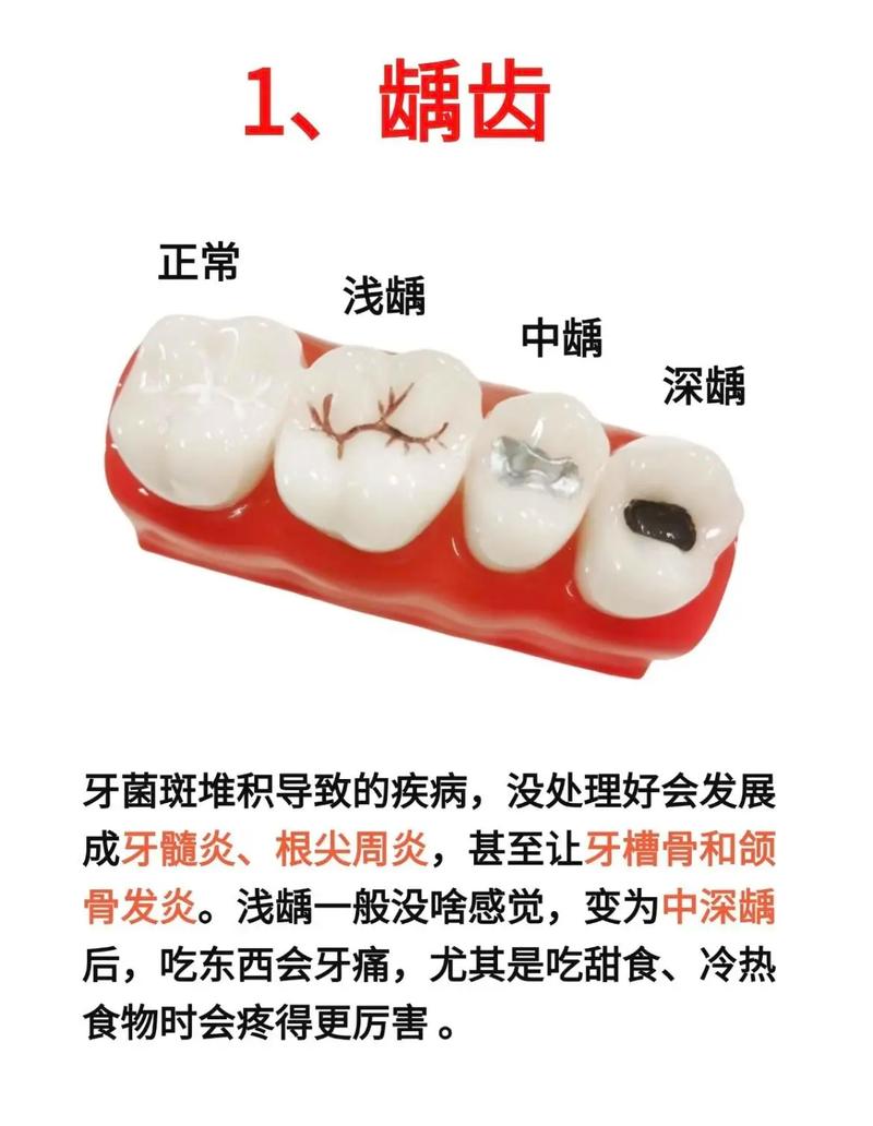 为什么总是晚上牙疼