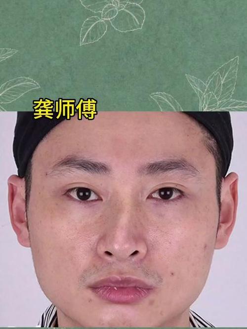 鼻什么弯曲