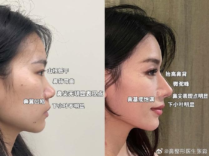 鼻什么弯曲
