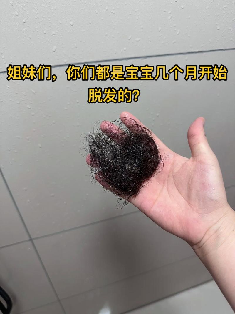 哺乳期为什么掉头发