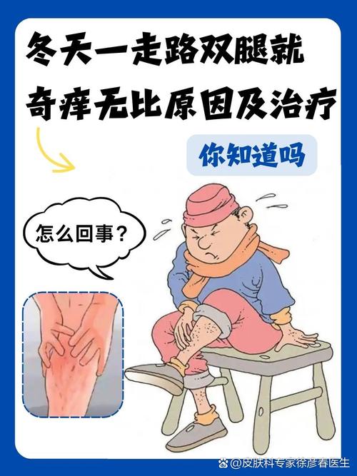 冬天腿痒是什么原因