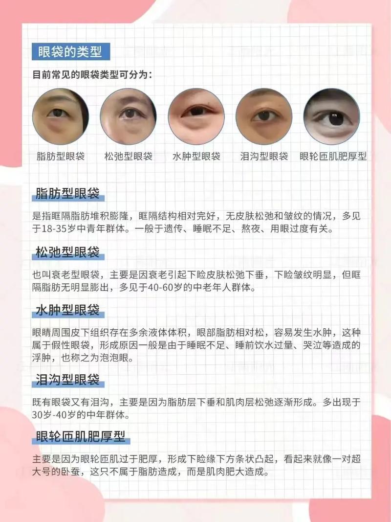 去眼袋有效方法是什么