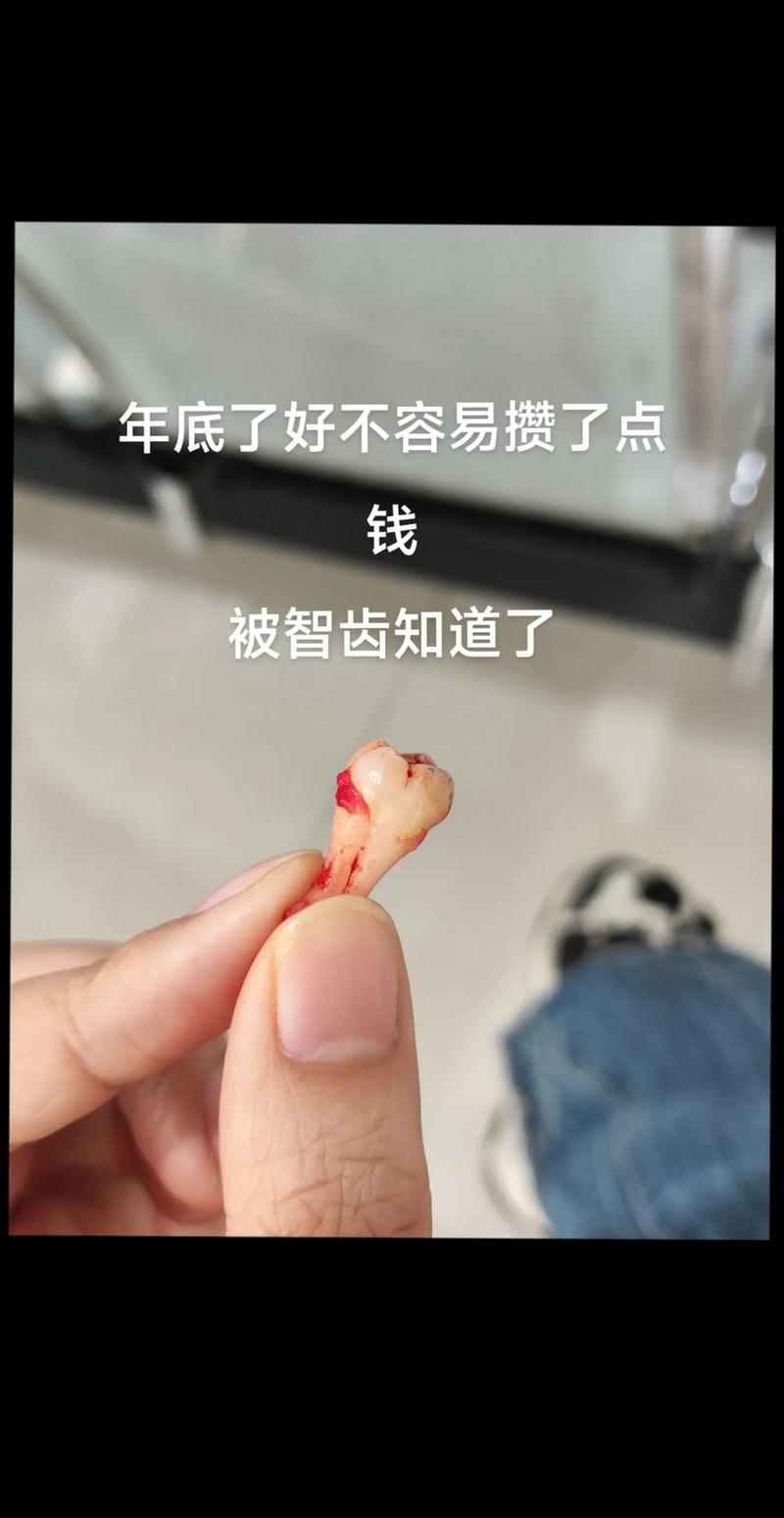 为什么拔智齿要缝针