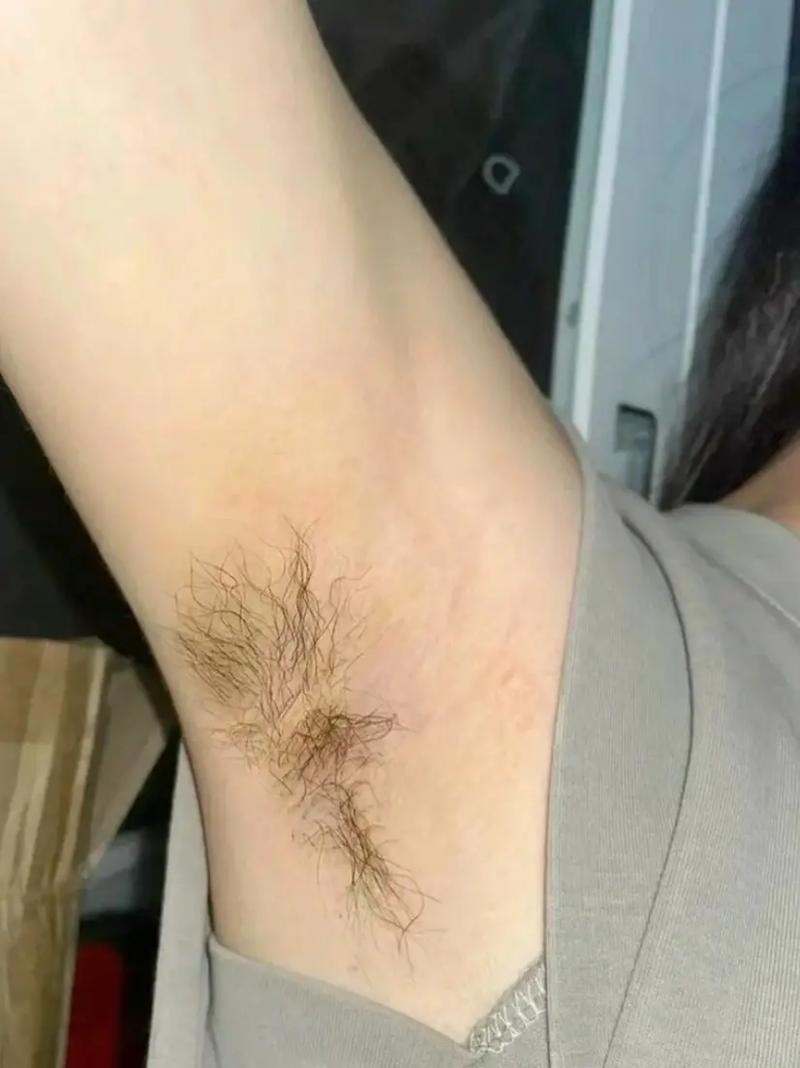 为什么女生会长腋毛