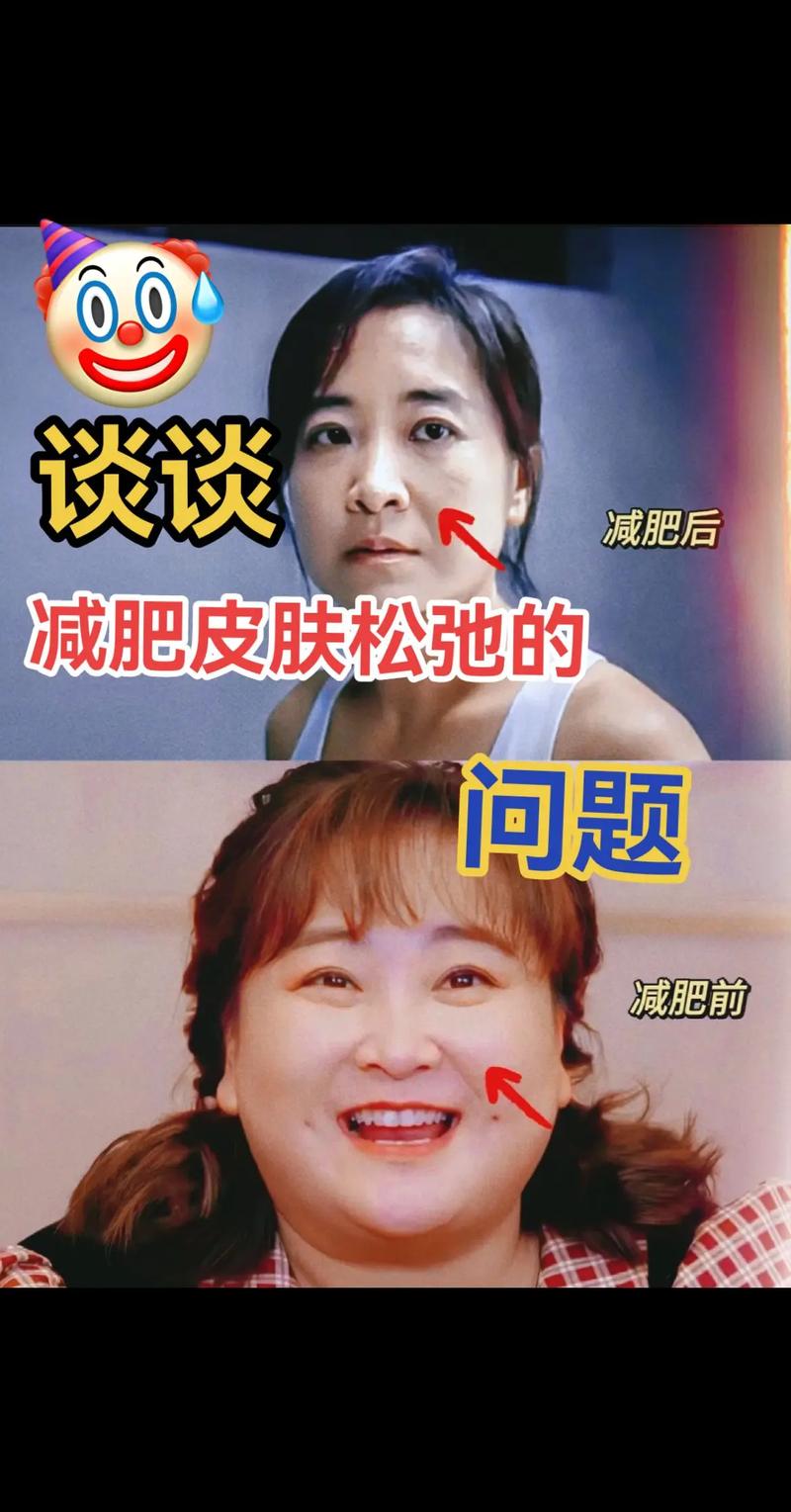 减肥为什么脸反而变大了