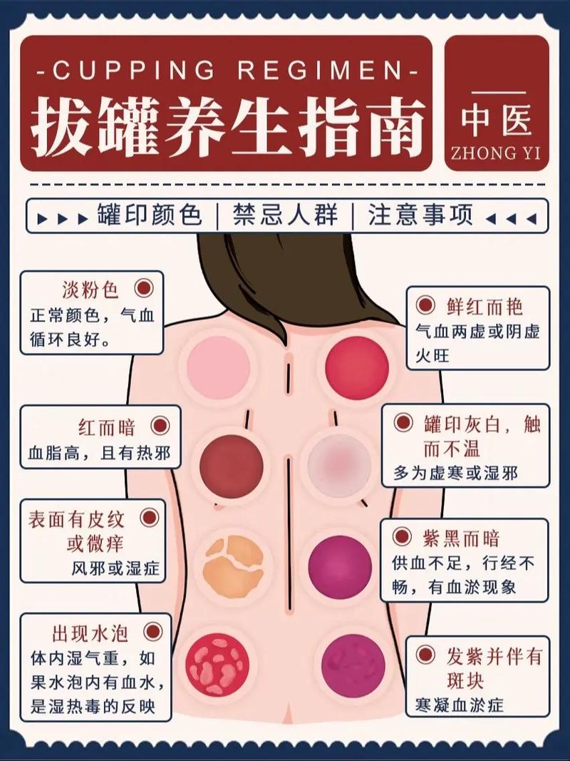 拔罐减肥饮食上要注意什么