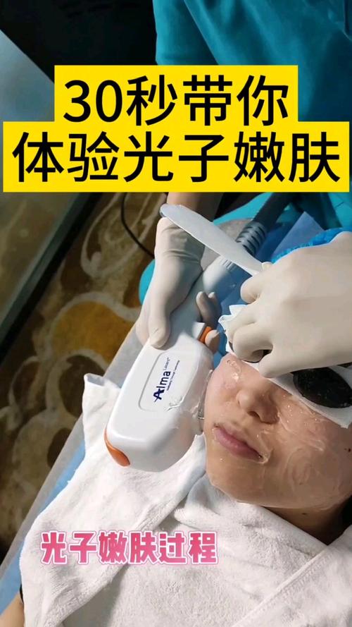 光子嫩肤是什么光