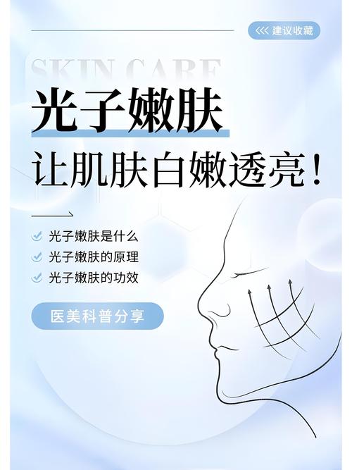 光子嫩肤是什么光