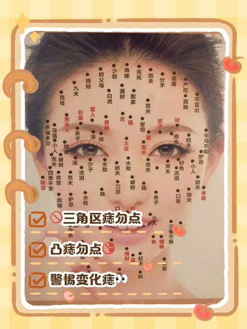 脸上什么痣不能取