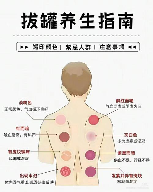 拔罐能减肥有什么好处