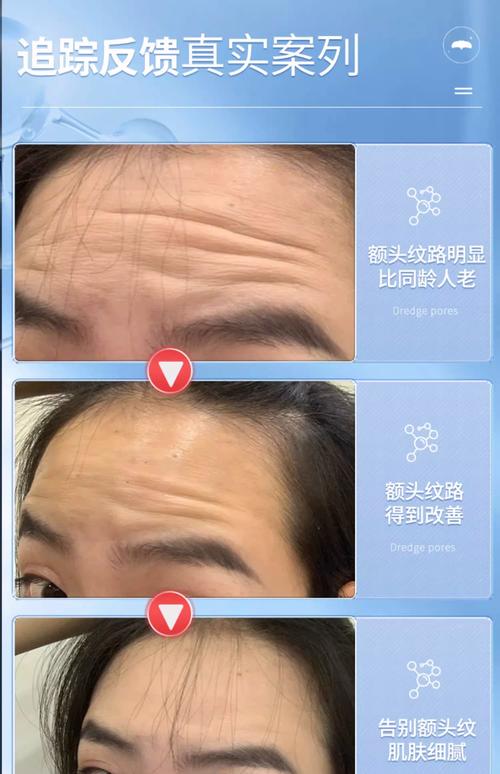 用什么去皱纹