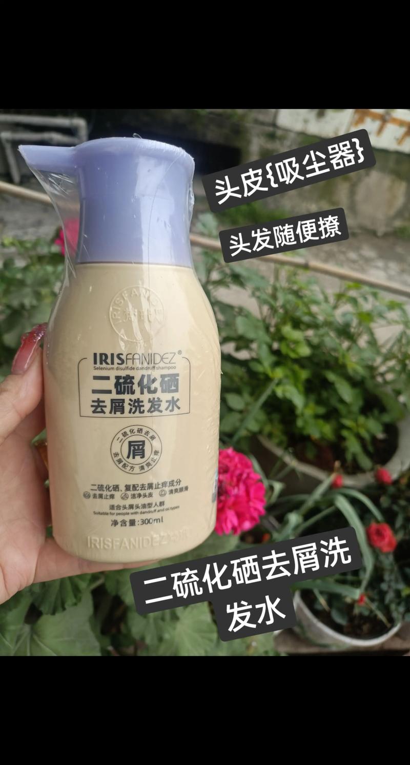 头皮屑用什么洗发水好