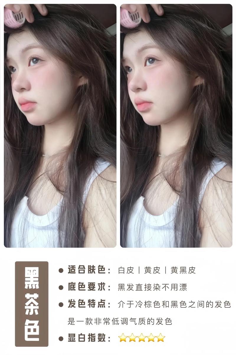 皮肤黄染什么颜色显白