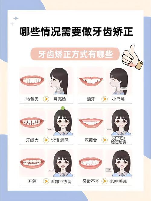 什么情况需要牙齿矫正