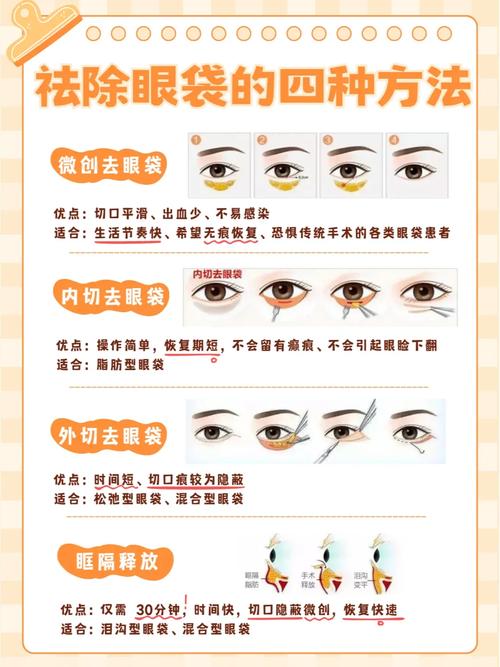去眼袋有什么好方法