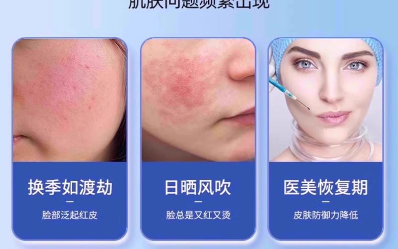 脸过敏可以用什么