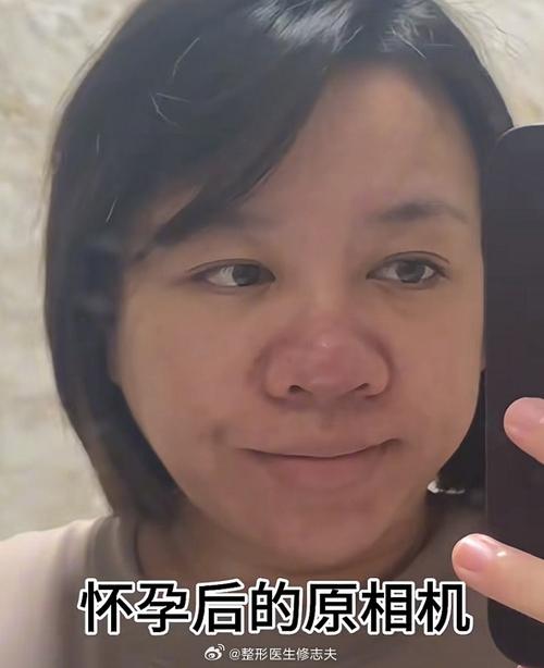 鼻子为什么变大了