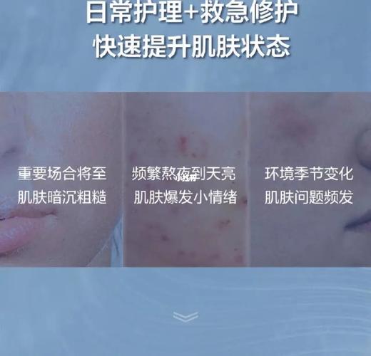 兰蔻小黑膜面膜怎么样