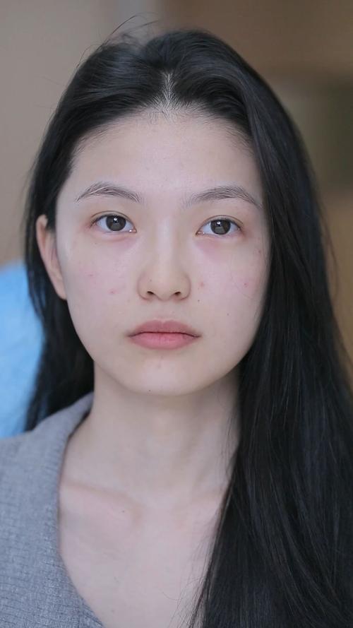 v脸针是什么