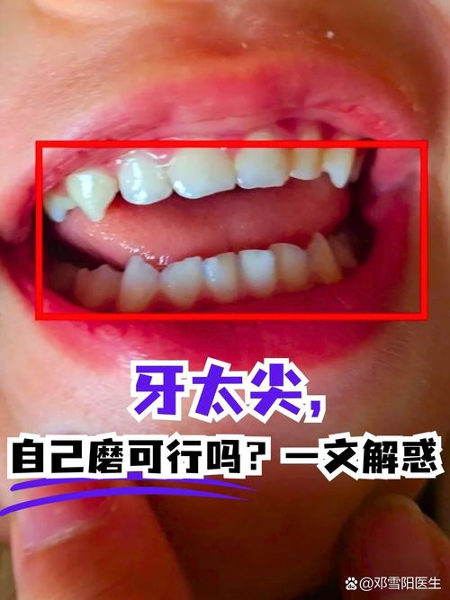 什么是滴牙